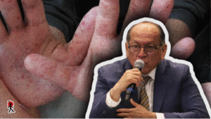 El secretario de Gobernación, Samuel Aguilar Pala, confirmó brotes del virus Coxsackie en escuelas de Izúcar de Matamoros y Amalucan